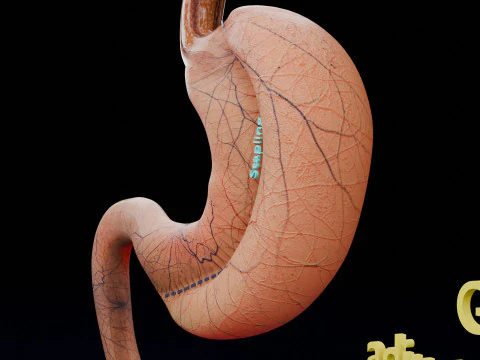 Bariatric Surgery Types 3D Model