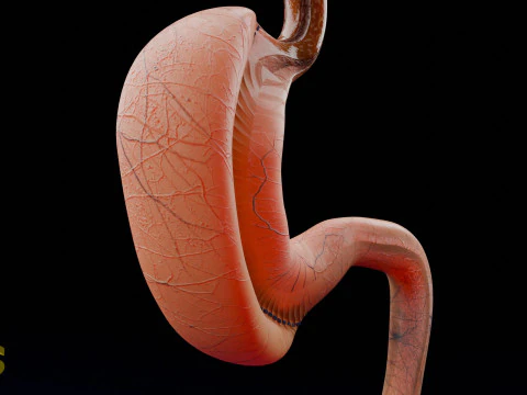 Bariatric Surgery Types 3D Model