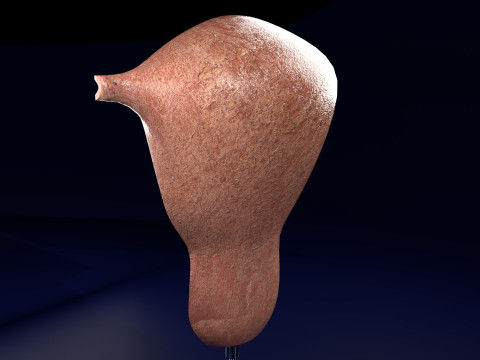 Endometrial Polyp Electrocautery Modello 3D