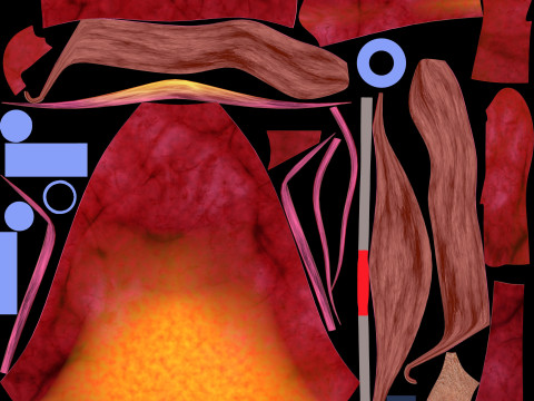 Endometrial Polyp Electrocautery Modello 3D