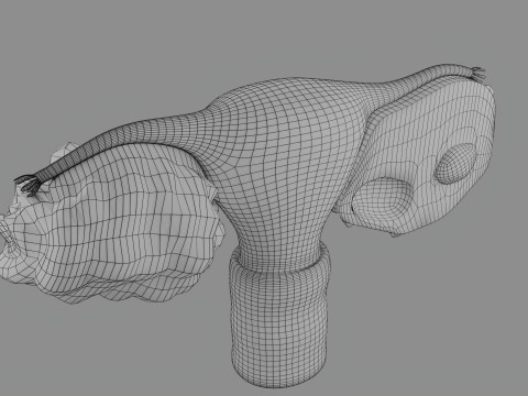 Krukenberg ovarian cancer tumor Modelo 3D