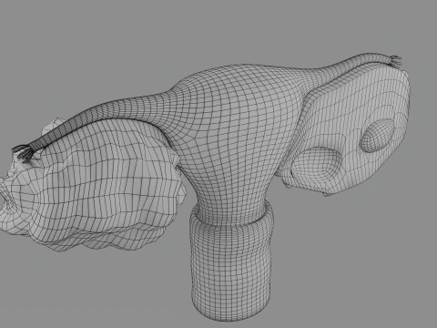 Krukenberg ovarian cancer tumor 3D Model