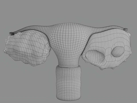 Krukenberg ovarian cancer tumor 3D Model