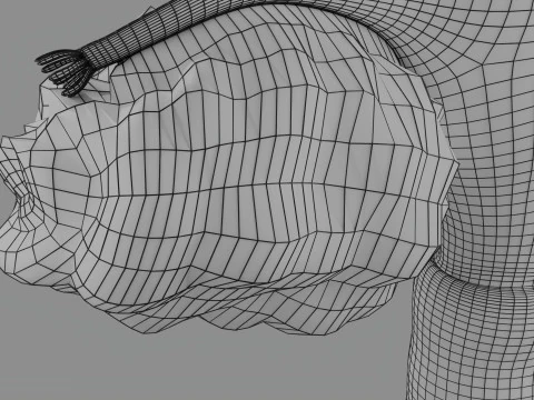 Krukenberg ovarian cancer tumor 3D Model