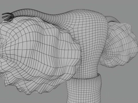 Krukenberg ovarian cancer tumor 3D Model
