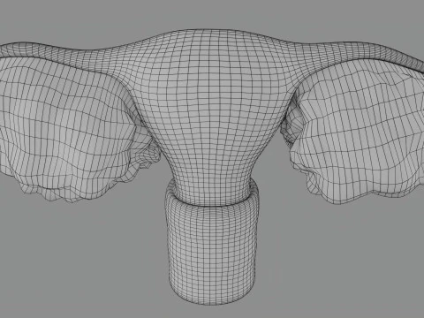 Krukenberg ovarian cancer tumor 3D Model