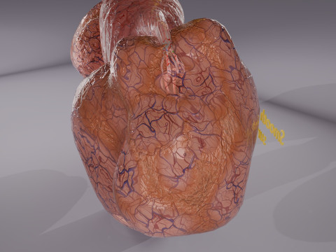 Ovary tumor benign non-cancerous serous cystadenoma Modèle 3D