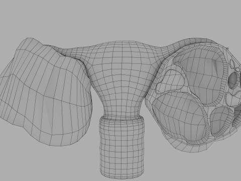 Ovary tumor benign non-cancerous serous cystadenoma Modèle 3D