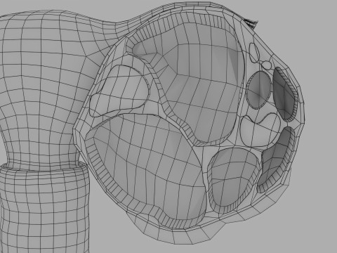 Ovary tumor benign non-cancerous serous cystadenoma Modèle 3D