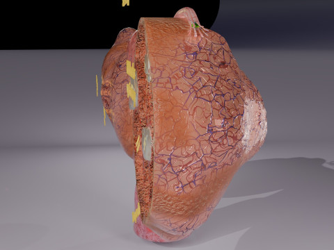 Ovary tumor benign non-cancerous serous cystadenoma Modèle 3D