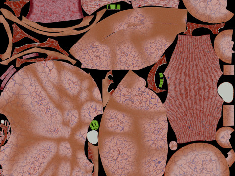 Ovary tumor benign non-cancerous serous cystadenoma Modèle 3D