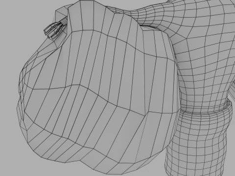 Ovary tumor benign non-cancerous serous cystadenoma 3D Model