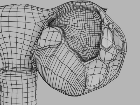 Ovary mucinous cystic tumor 3D Model