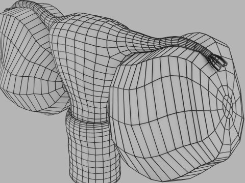 卵巢粘液性囊性肿瘤 3D 模型