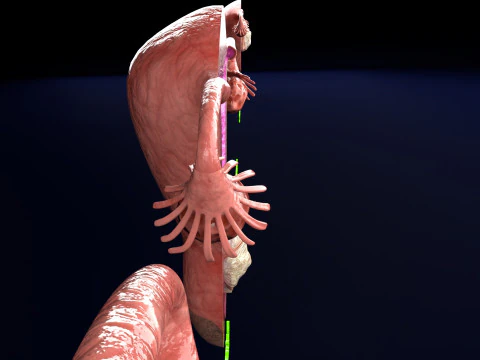 Uterus normal versus fibroid types 3d set 3D Model