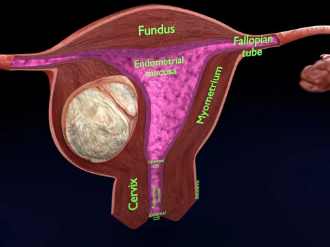 Uterus normal versus fibroid types 3d set 3D Model