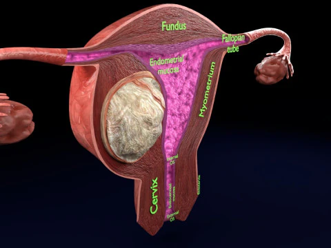 Uterus normal versus fibroid types 3d set 3D Model