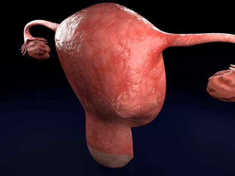 Uterus normal versus fibroid types 3d set 3D Model