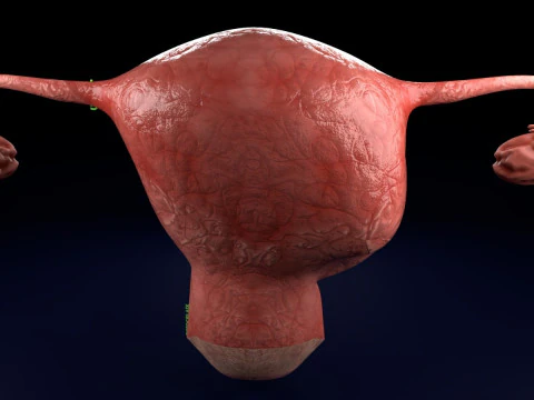 Uterus normal versus fibroid types 3d set 3D Model