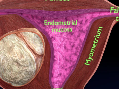 Uterus normal versus fibroid types 3d set 3D Model
