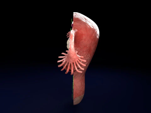 Uterus normal versus fibroid types 3d set 3D Model