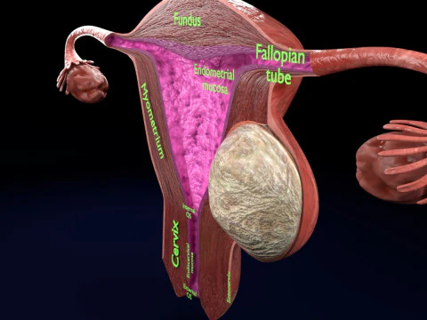 Uterus normal versus fibroid types 3d set 3D Model