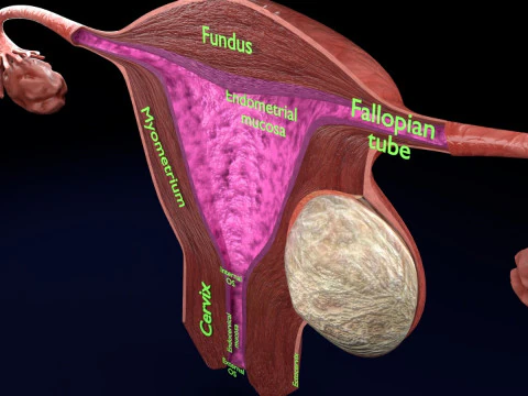 Uterus normal versus fibroid types 3d set 3D Model