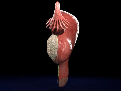 Uterus normal versus fibroid types 3d set 3D Model