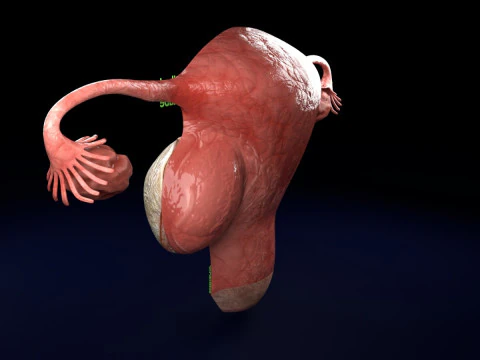Uterus normal versus fibroid types 3d set 3D Model