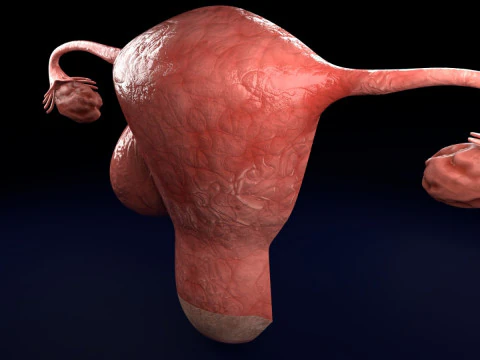 Uterus normal versus fibroid types 3d set 3D Model