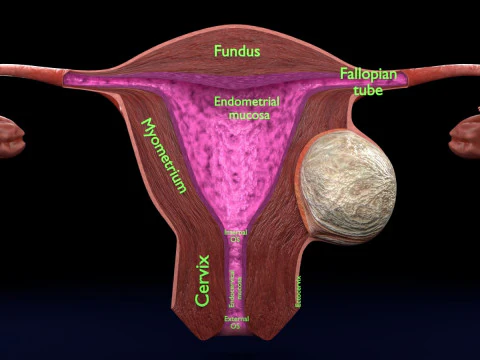 Uterus normal versus fibroid types 3d set 3D Model