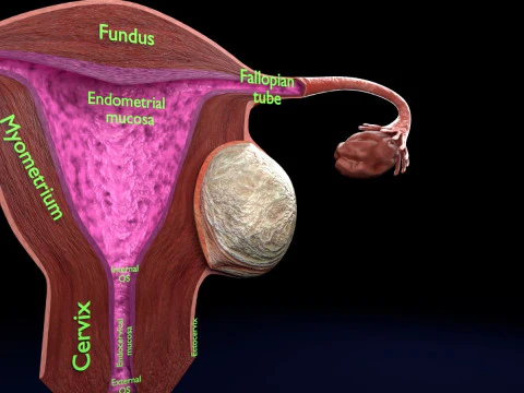 Uterus normal versus fibroid types 3d set 3D Model