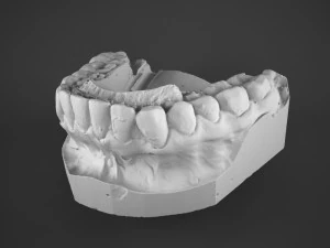 plaster teeth 3D Model