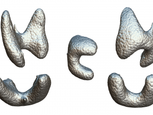 Healthy Thyroid and Thyroid Cancer 3D Model