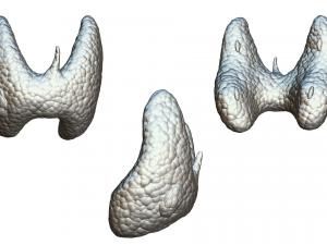 Healthy Thyroid and Thyroid Cancer 3D Model