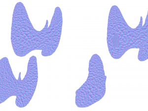Healthy Thyroid and Thyroid Cancer 3D Model
