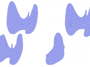 Healthy Thyroid and Thyroid Cancer 3D Model