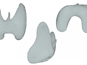 Healthy Thyroid and Thyroid Cancer 3D Model