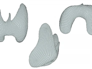 Healthy Thyroid and Thyroid Cancer 3D Model