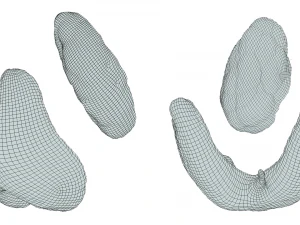 Healthy Thyroid and Thyroid Cancer 3D Model