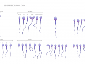 Sperm Morphology Normal and Abnormal 3D Model