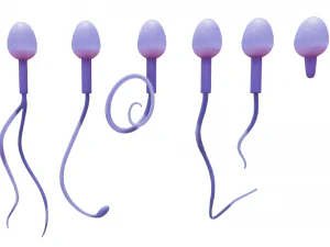 精子の形態の正常と異常 3Dモデル