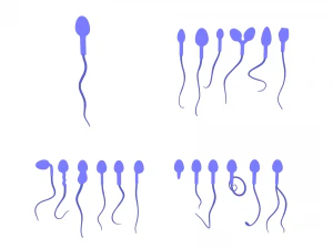 精子の形態の正常と異常 3Dモデル