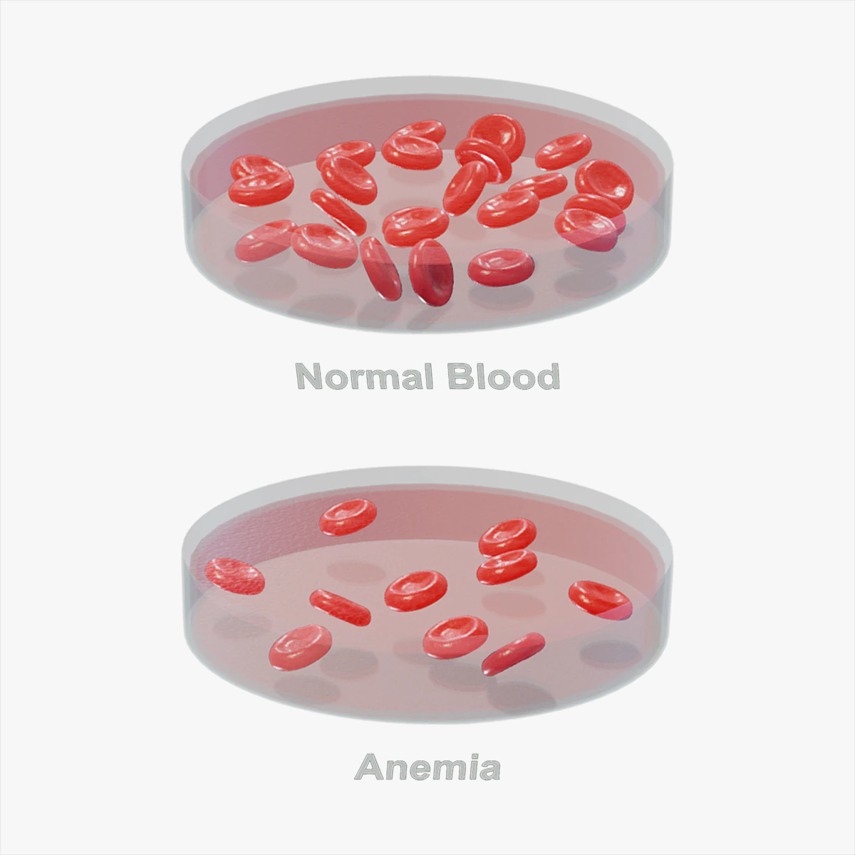 Normal Blood Cells vs Anemia 3D Model .c4d .max .obj .3ds .fbx .stl .blend