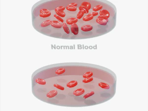 Cellule del sangue normali e anemia Modello 3D
