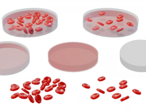 Normal Blood Cells vs Anemia 3D Model