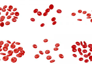 Normal Blood Cells vs Anemia 3D Model