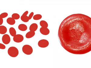Normal Blood Cells vs Anemia 3D Model