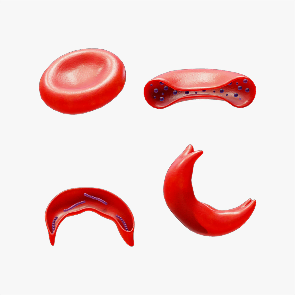 Cross Section of Normal vs Sickle Red Blood Cell 3D Model .c4d .max .obj .3ds .fbx .stl .blend 