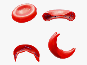 Cross Section of Normal vs Sickle Red Blood Cell 3D 모델
